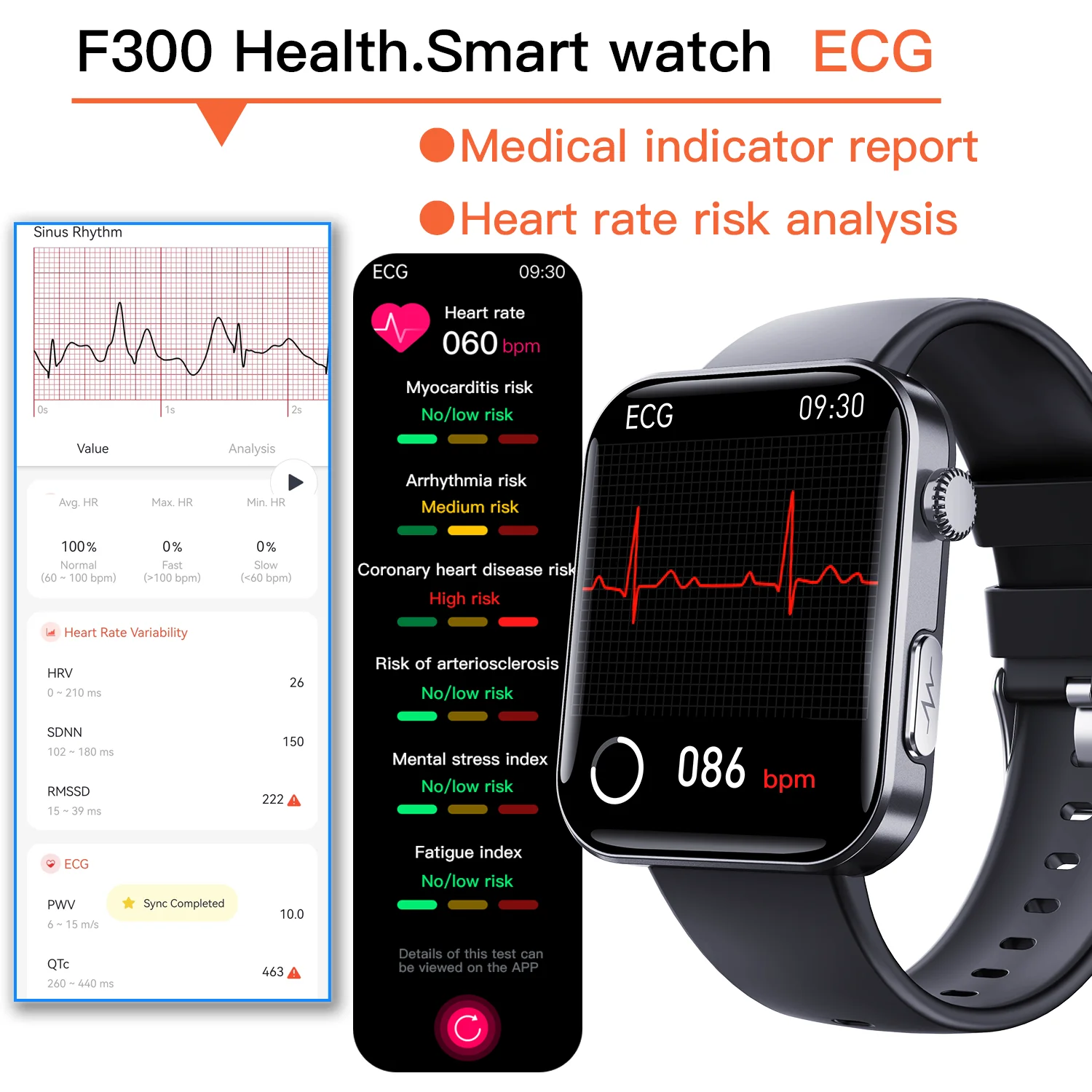 Smart blood sugar watch 24h measurement of glucose, blood pressure, blood lipids, uric acid, ECG, wireless Bluetooth smart APP