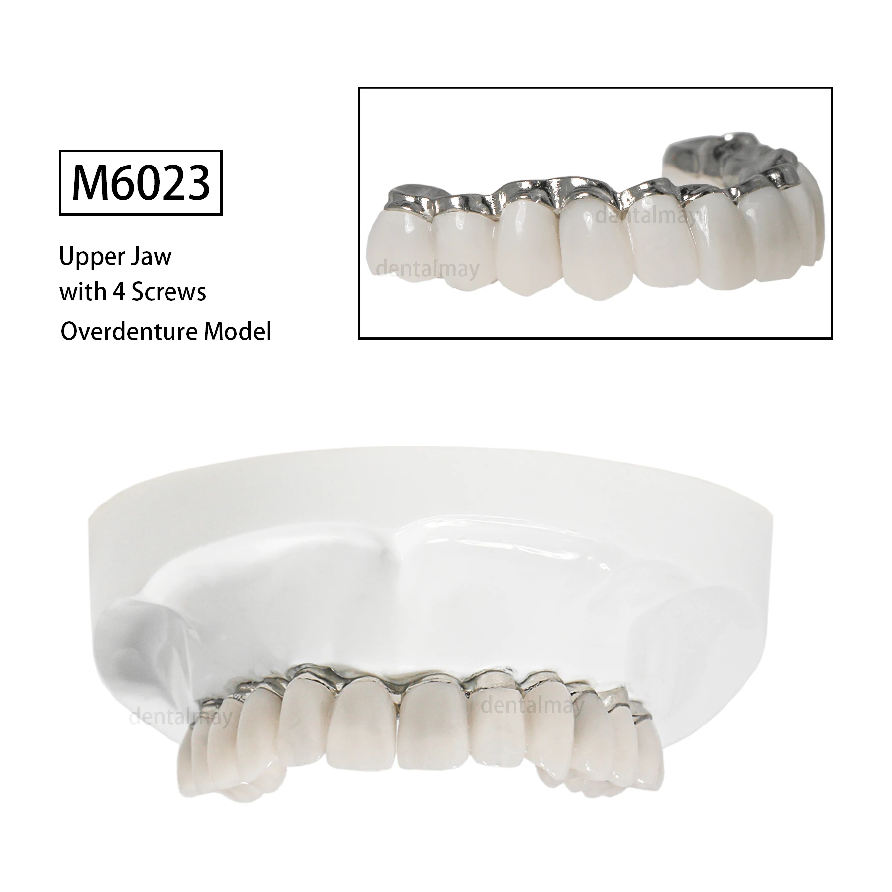 

Dental All-on-4 Overdenture Teeth Model Upper Jaw Implants Restoration 4 Screws M6023