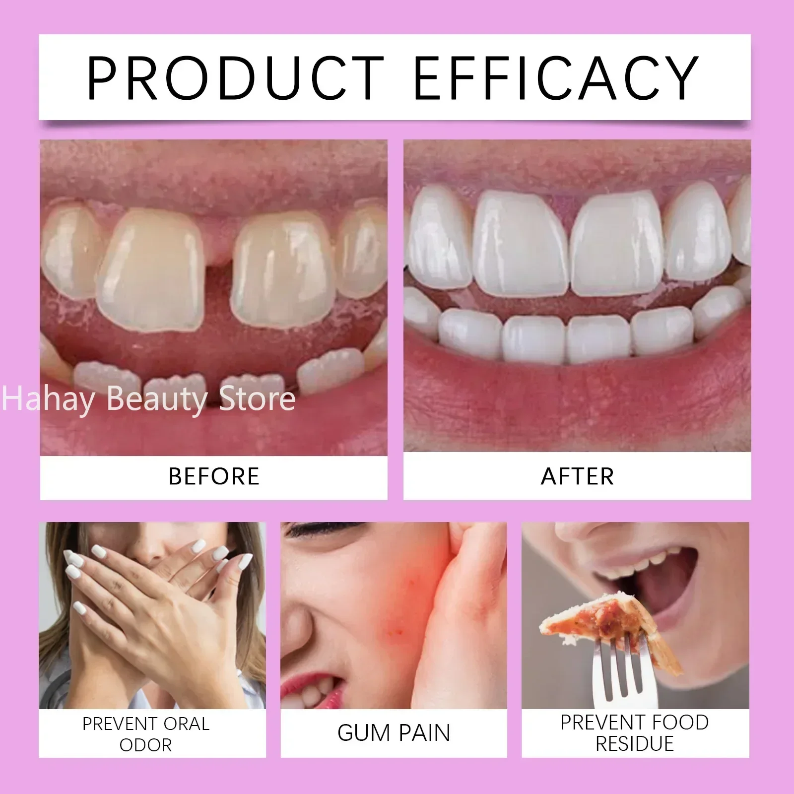 치과 Thermoplastic Denture Adhesive &cushion Reduce Gum Pain Caused Friction Fixed Dentures Enhance Comfort Denture Care Products