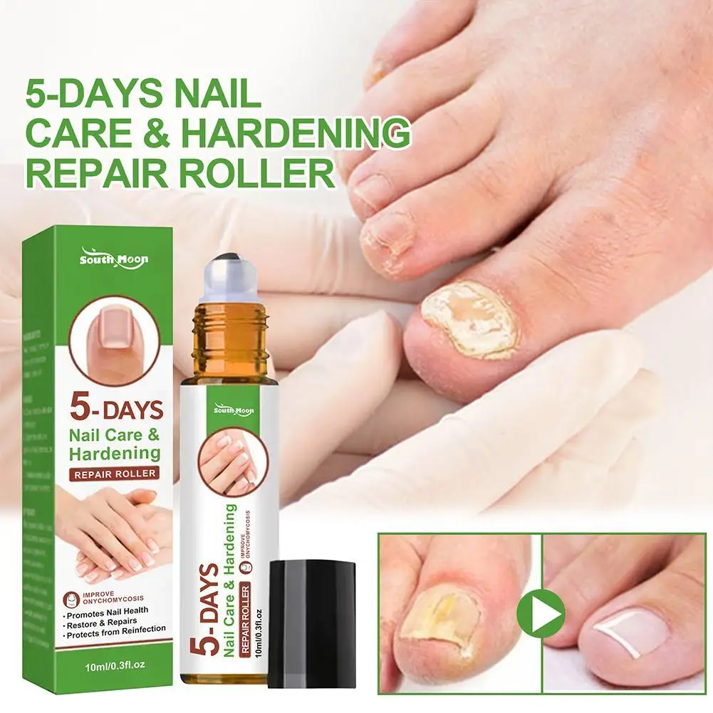 5 Days Nail Growth And Hardening Repair Roller Nail Nail Solution Nail Nutrient Thickening Repair Brightening Softening Rem S0V9