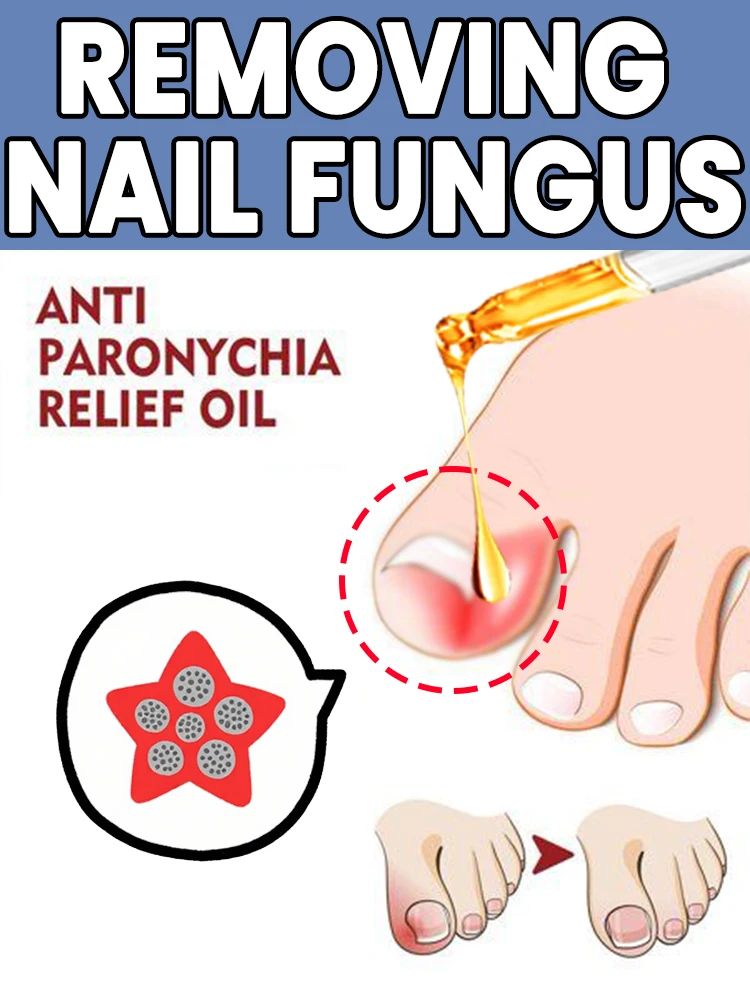 

Nail fungus remover, nail fungus repair magic tool, gentle removal of stubborn fungus, nail care and nail nourishment