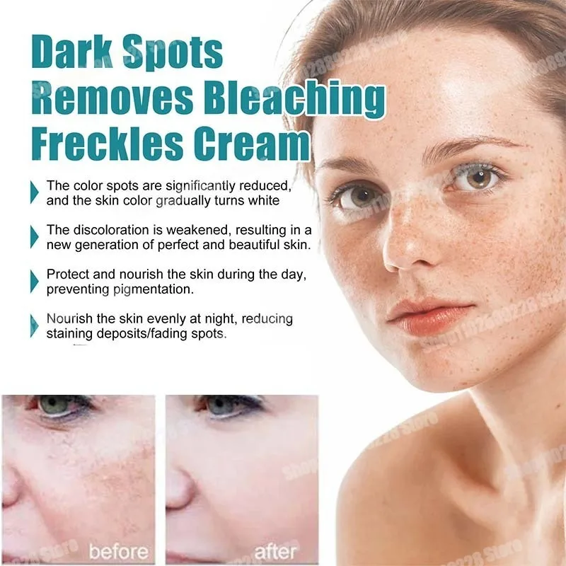 Face Whitening And Freckle Removing Cream Nicotinamide Brightening And Moisturizing Face Cream Fade Dark Spots Cream