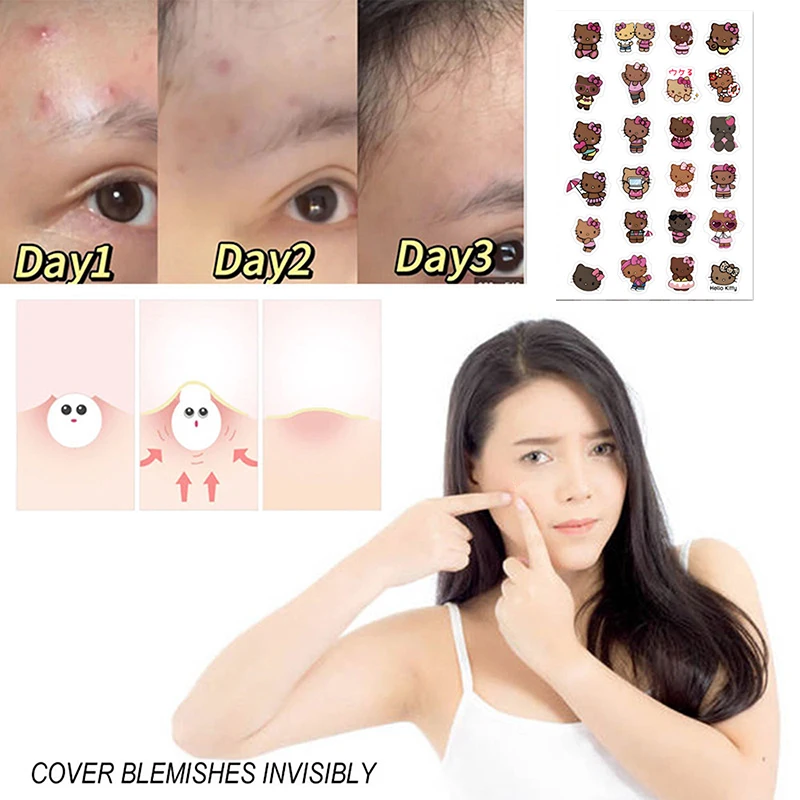 แผ่นแปะสิวรูปซานริโอ้ เฮลโลคิตตี้ 96 ชิ้น ลายการ์ตูนคุโรมิ แผ่นปิดสิวแบบใส ปกปิดสิว กำจัดสิว แผ่นแปะดูแลผิว