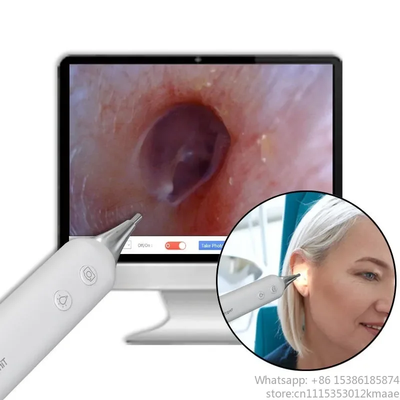 Vequyn Portable Digital USB Visual Endoscope Otoscope Microscope with Camera Speculum