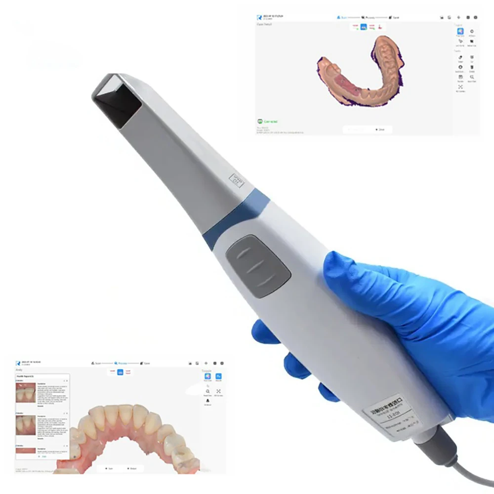 Scanner dentaire 3D, Instrument d'empreintes digitales, affichage en temps réel, Transmission d'image, outils de dentiste