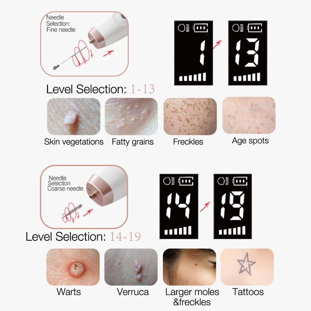 Elektrischer Warzenentfernungsstift mit 19 Einstellbaren Stufen für Hautflecken, Sommersprossen, Hautanhängsel und Tattoo-Entfernung - Beauty Plasma Pen/Ersatznadeln – Detail 16