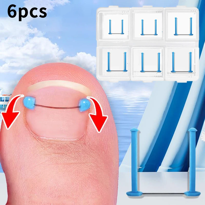 Ingrown Toenail Blue Correction Wire Set Foot Care Professional Treatment Recover Embed Toe Nail Pedicure Straightening Toe Tool