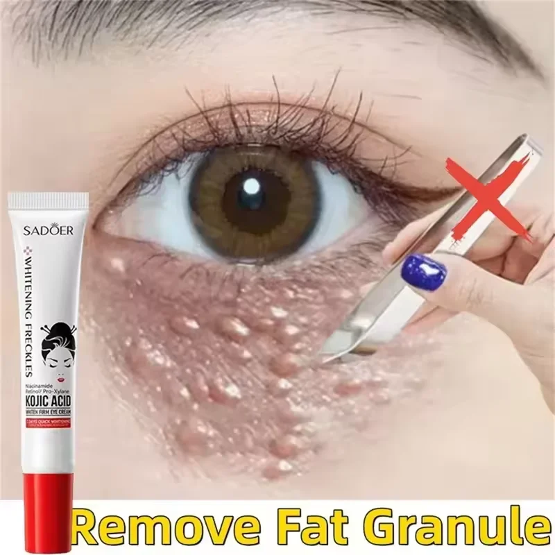 Fat Granules Remover Eye Cream Anti-Puffiness Anti Inflammatory Reduce Dark Circles Eyebags Fade Lines Moisturizing Eye Care New