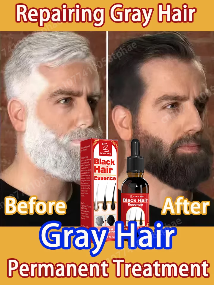 turns-gray-hair-into-black-hair-natural-color-repair-hair-serum-penetrates-quickly-and-provides-deep-nutrition
