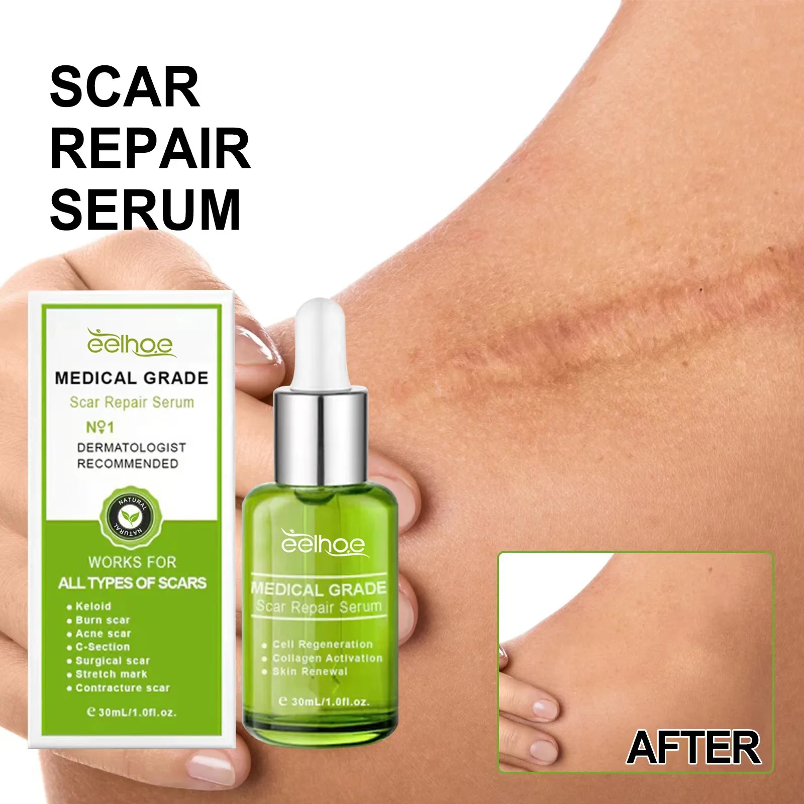 

scar repair essence care, repair, smooth skin, fade scars, acne marks, pregnancy scars