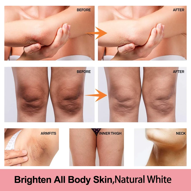 VitaminC Whitening Cream For Dark Skin Lighten Pigment Crotch Armpit Body Brighten Cream Moisturizer Korean Skin Care Product50g