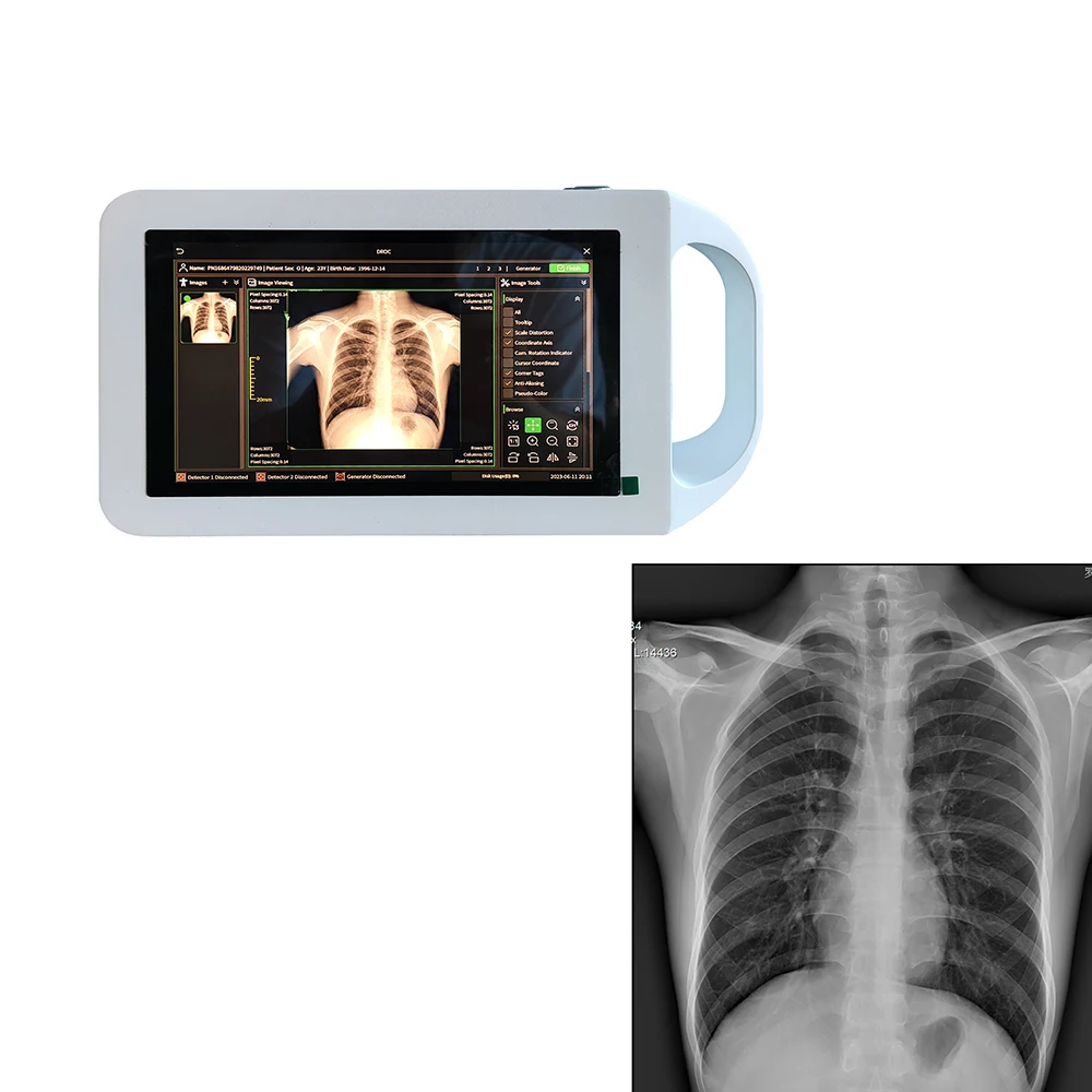 Medical Radiography Mini 8-inch LCD Screen Digital Handheld Portable X-ray Machine