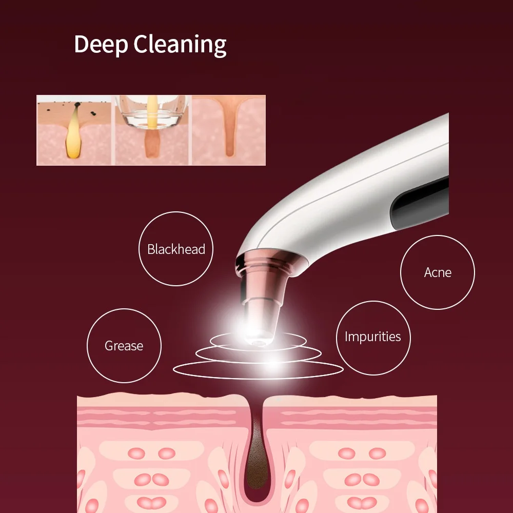 USB Rechargeable Visual Blackhead Remover Vacuum Suction Visual Camera Connection Acne Extractor Pore Cleaner Beauty Tools - Image 6