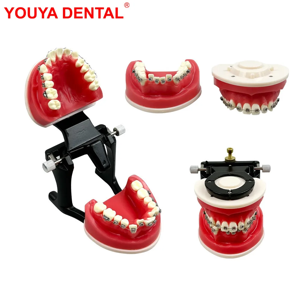 

New Dental Orthodontic Treament Model With Bracket Wax Gums Ortho Teeth Model For Training Practice Teaching Studying Typodont