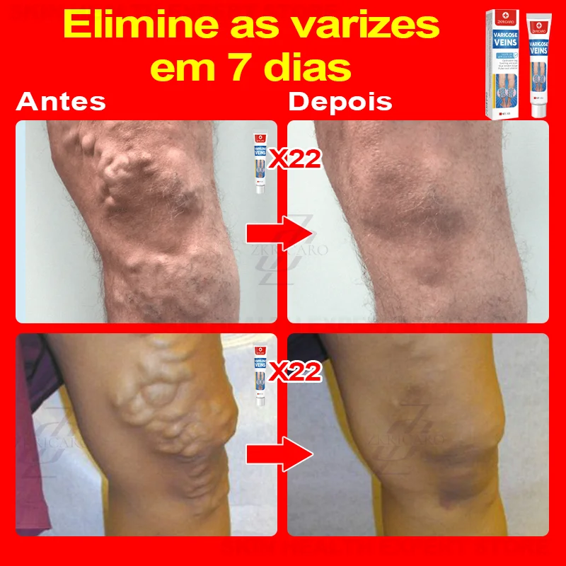 Promova Sangue