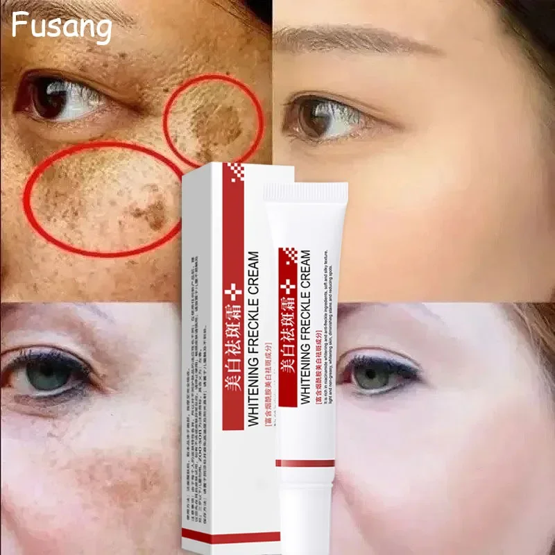 Women Fade Melasma Cream Lightening Dull Brightening Emulsion Reduce Melanin Brighten Cream For Dark Skin Face Moisturiz Product