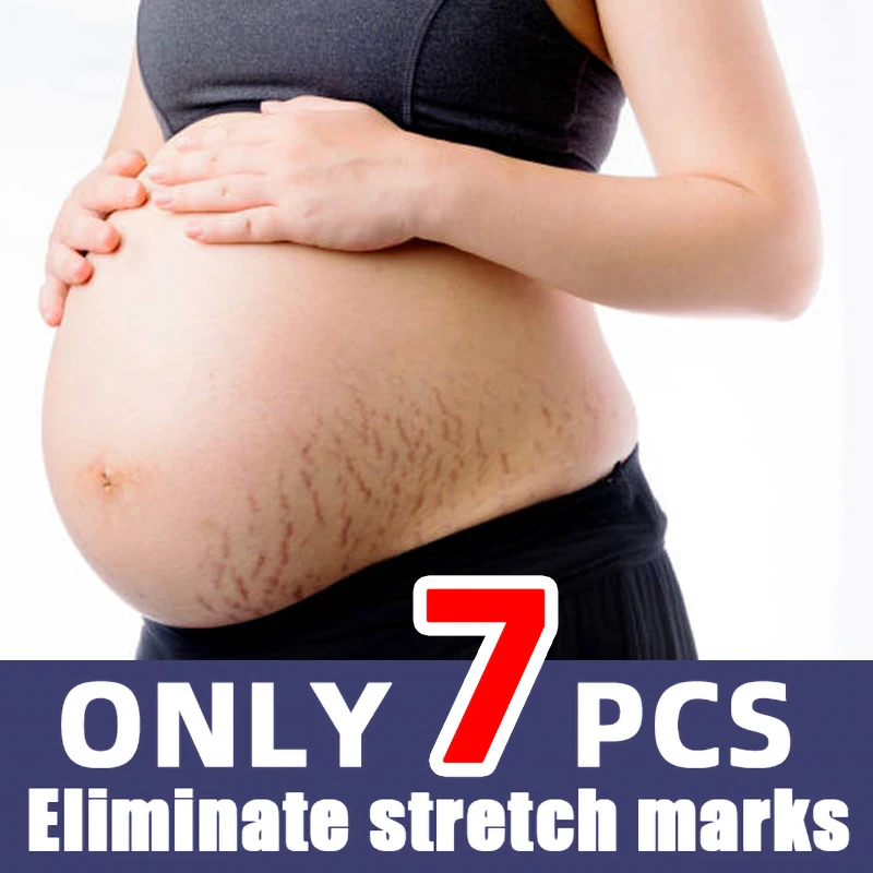 

Stretch Mark Repair Cream For Pregnant Women Postpartum Care Firm Light Lines Obesity Lines Growth Lines Repair Cream