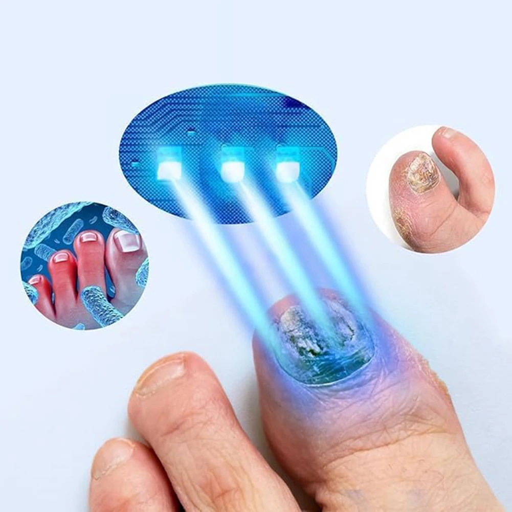 

Световое устройство для грибка ногтей Устройство для очистки грибка ногтей Перезаряжаемая машина для очистки грибка ногтей на ногах для паронихии, онихомикоза