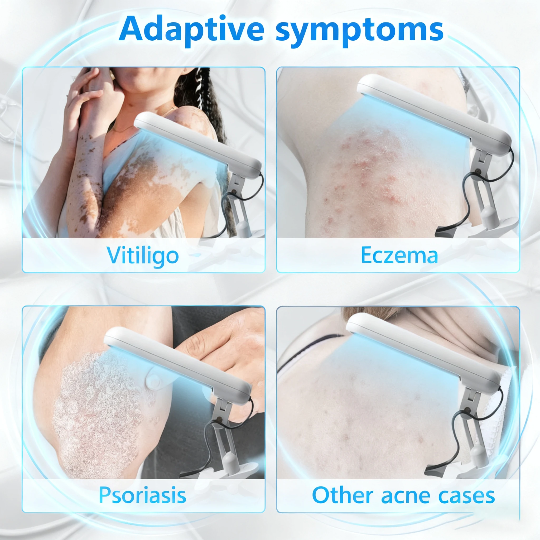 Instrumento de terapia de banda estrecha UVB de 311nm, lámpara de fototerapia UV para lámpara de terapia de Vitiligo, tratamiento de enfermedades de la piel de la Psoriasis en el hogar