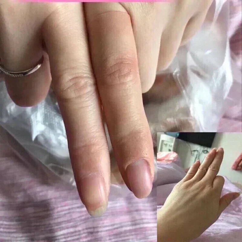The Disabled Finger Fake Finger Glove The Disabled Finger Custom-made Fake Palm Simulation