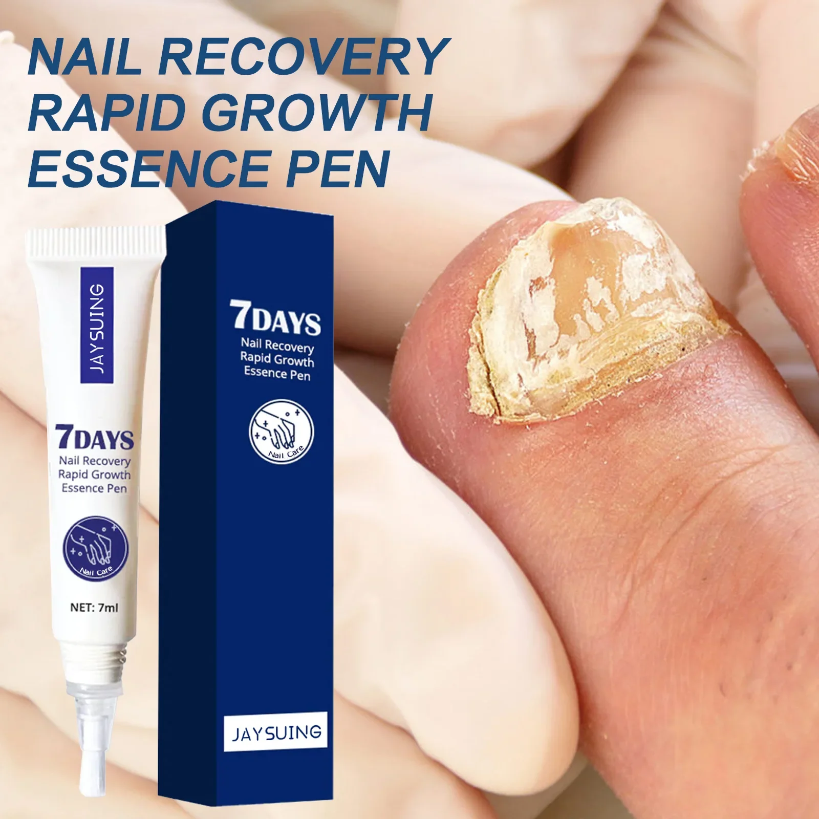 

7ml Nail Recovery Rapid Growth Essence Pen Nail Foot Toe Care and Nourishment 98% of Customers Repurchase and Get Perfect