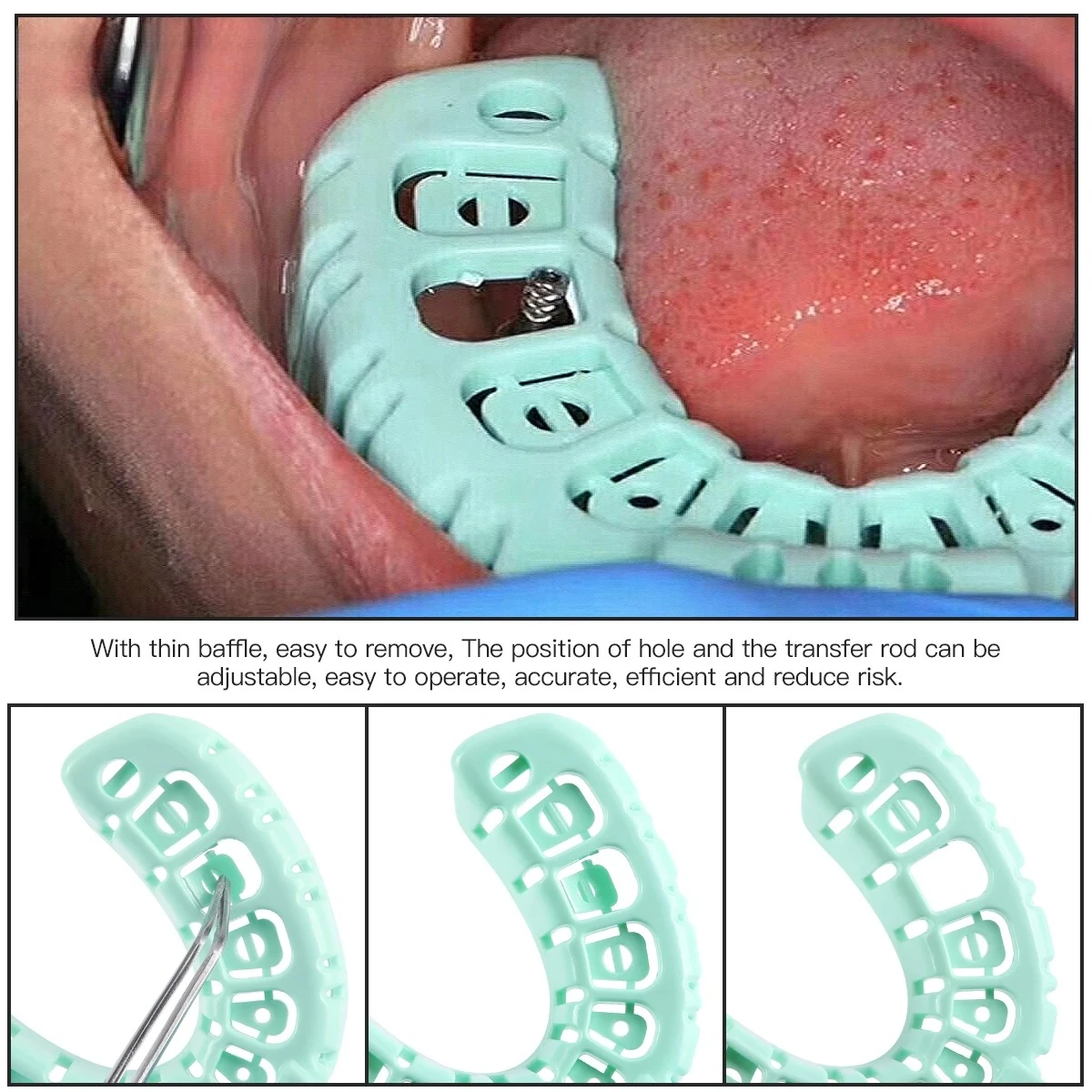 Dental Implant Tray Two Color Optional High Temperature Resistant Full Mouth Impresion Tray Can Move Part Mold L M S Dental Tool
