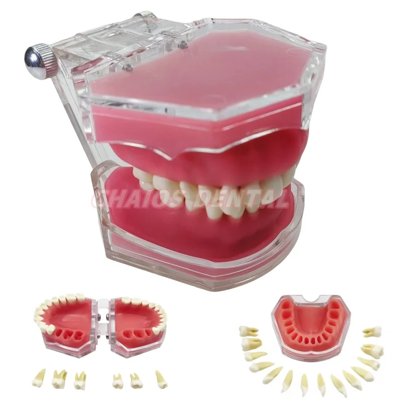 1Pcs Extraction Model Dental Standard Typodont Model Soft Gum With 28 Removable Teeth Adult Practice Model For Dentist Teaching