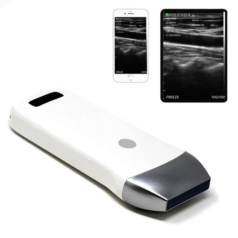 

Wireless WiFi Mini Handheld Machine / Scanner Probe B/M