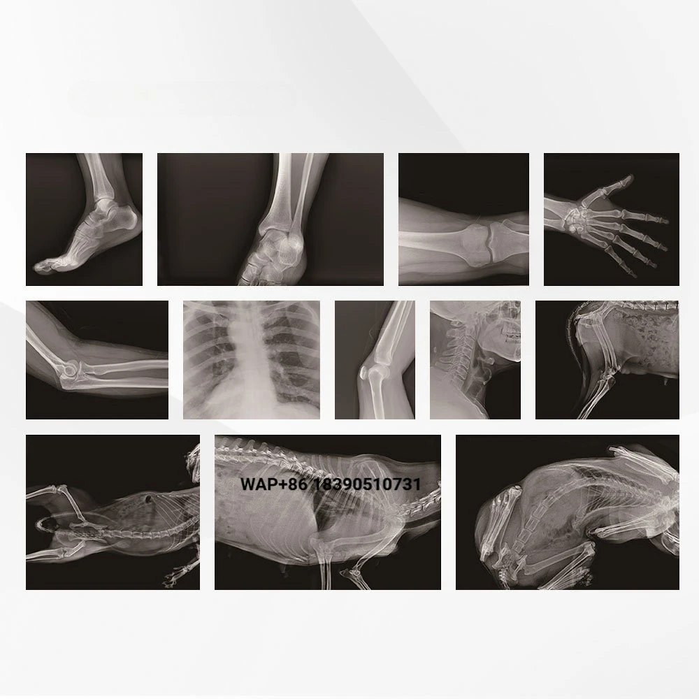 Unique miniature design portable X-ray battery-powered digital imaging X-ray machine for , spinal, limb, and veterinar