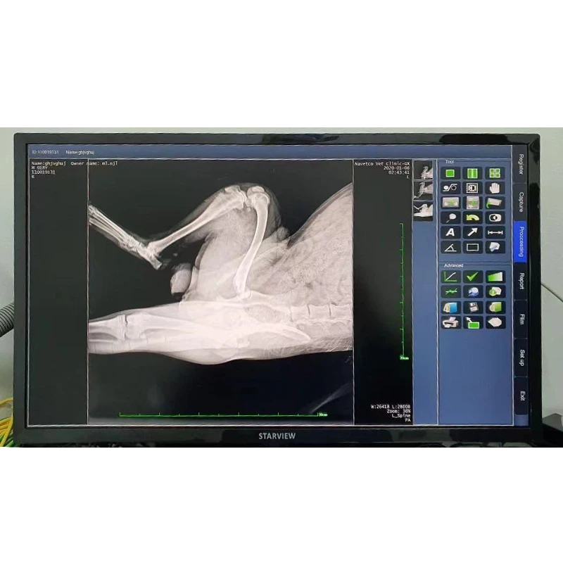 Veterinary X-ray  Device DR Machine  Generator Digital Radiography Vet Equipment for Human & Pets