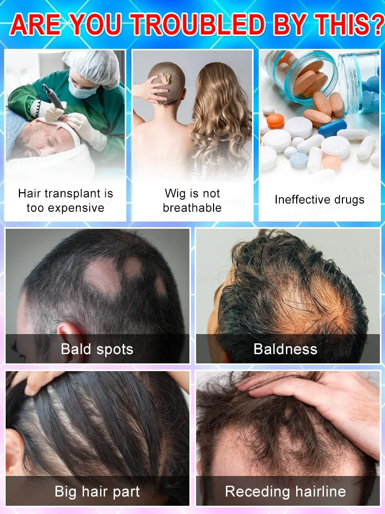 Haz el bosque del tiempo más exuberante, la pulverización diaria puede fortalecer las raíces y promover el nuevo crecimiento.