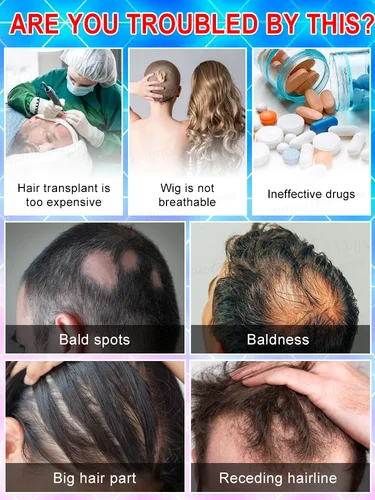 Imagen 2 del producto Que tengas el sueño de tener una cabeza completa de cabello hermoso.