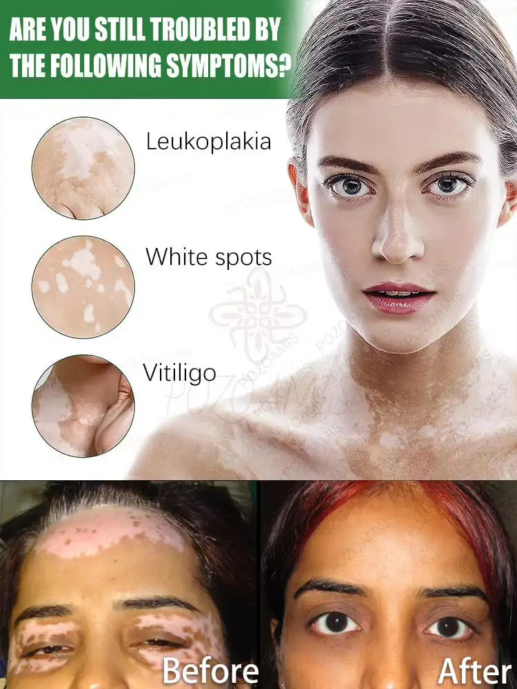 The laser pen is gentle and only acts on the ʷʰⁱᵗᵉ ˢᵖᵒᵗˢ ʷⁱᵗʰᵒᵘᵗ ᵈᵃᵐᵃᵍⁱⁿᵍ ʰᵉᵃˡᵗʰʸ ˢᵏⁱⁿ‧