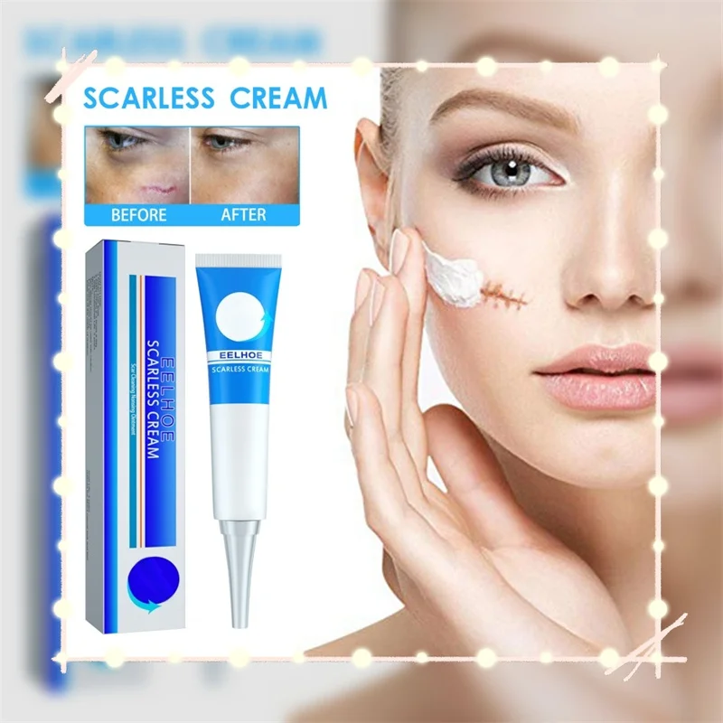 

Scar Removal Cream Gel Remove Acne Spots Treatment Stretch Marks Burn Surgical Scar Repair Cream Smoothing Whitening Skin Beauty