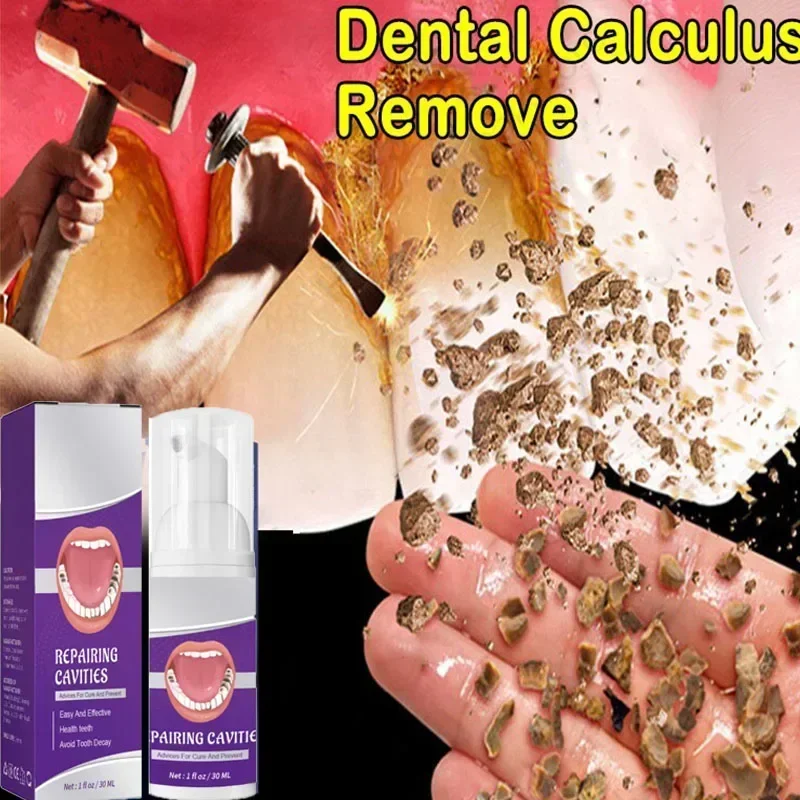 ²⁰²⁵ Toothpaste Whiten Clean Teeth Remove Stains Oral Care Management Fresh Breath