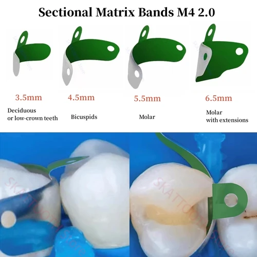 Imagen 2 del producto Bandas de matriz Dental M4 2,0, matrices metálicas contorneadas seccionales con revestimiento antiadherente de PTFE, materiales de odontología de matriz elástica