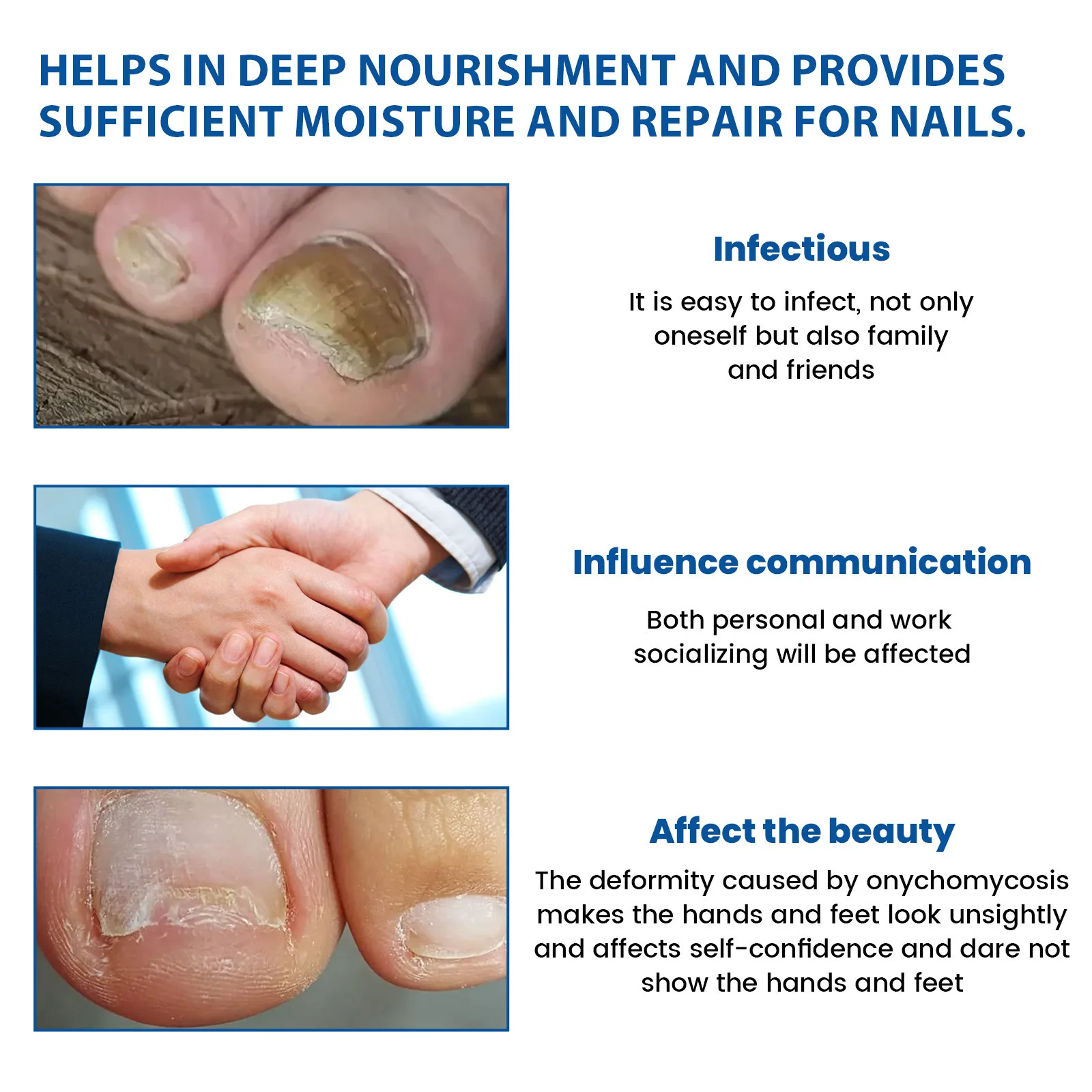 Remendo de tratamento de unhas nutre profundamente repara unhas danificadas unhas fungas cinza espessamento macio paroníquia tratamento adesivos