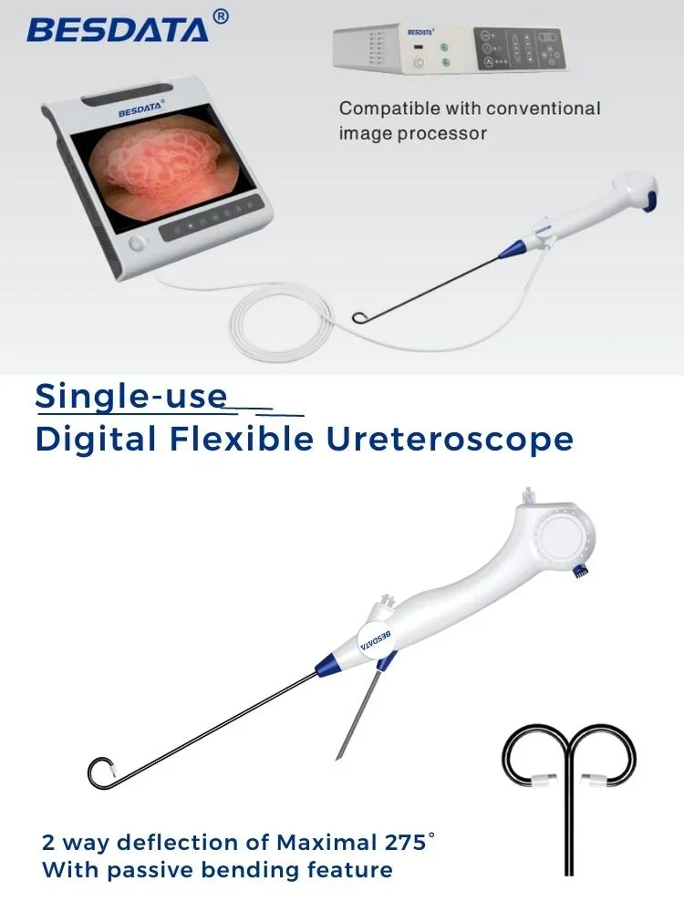 high quality Medical equipment trade portable disposable Flexible ENT Endoscope Set for nasal and laryngoscopy endoscopy