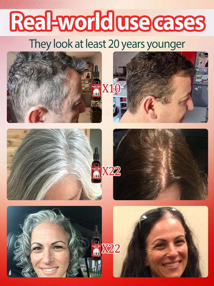 Gray Hair Restoration Natural Hair Color Gender: Unisex Hair Style;100% Effective