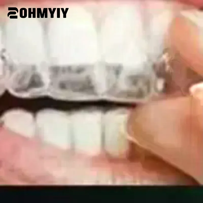 

10/15/20 Pcs Dental Lab Thermoforming Material Vacuum Forming Hard Sheets Splint Retainer Slice 1.0/1.5/2.0mm Dental Material