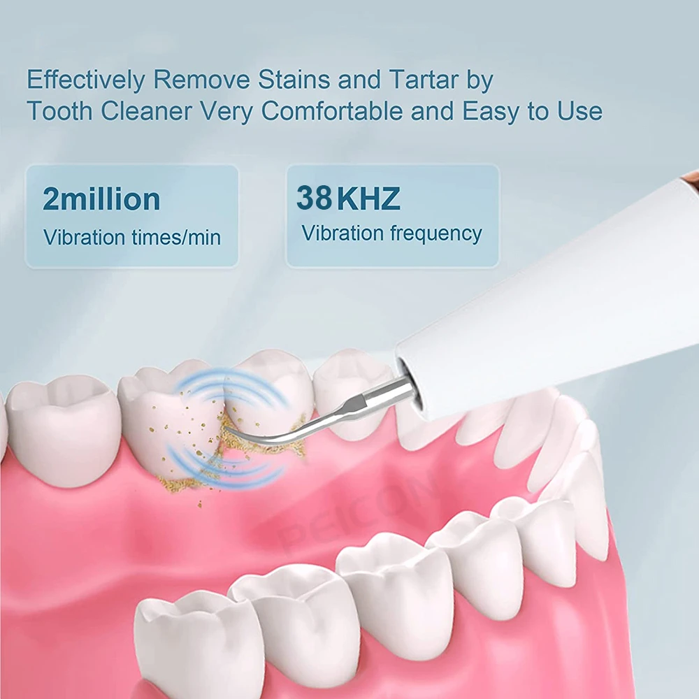 Thumbnail 2 - #1 Compare Ultrasonic Dental Scalers Before You Buy