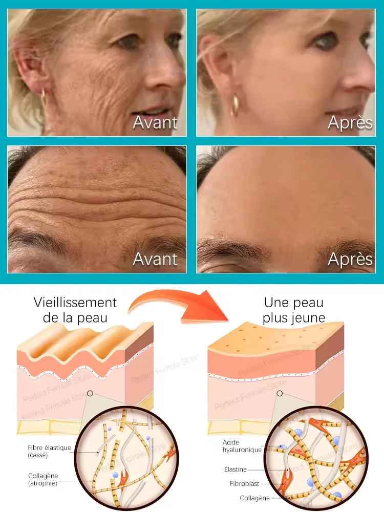 تغيير الجلد، قل وداعا للتجاعيد #3