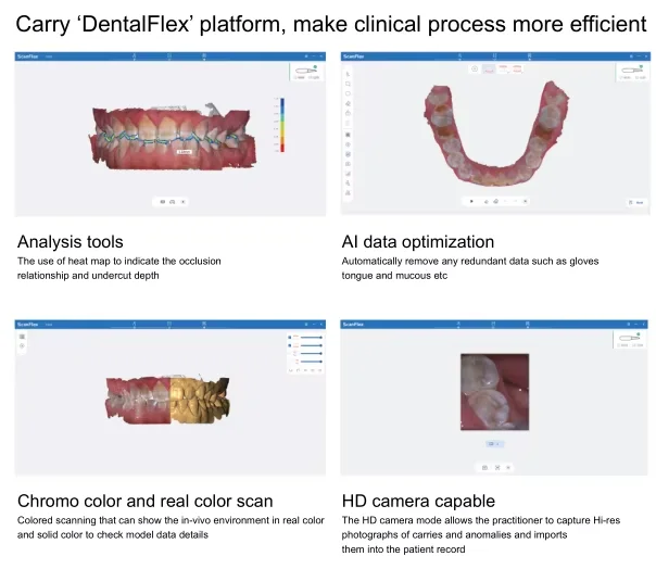 Fussen الأصلي S6500 الماسح الضوئي ثلاثي الأبعاد داخل الفم مع برنامج ثلاثية الأبعاد اللون الحقيقي مسح نموذج الأسنان التصوير لزراعة #4