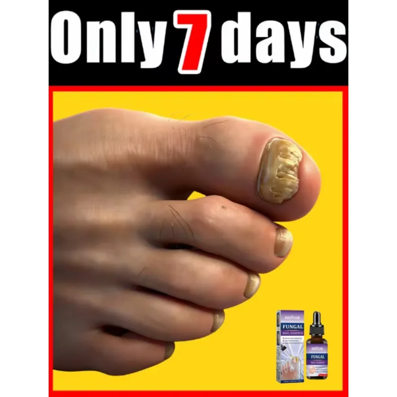 

YTS Rejuvenator - Fungus Prevention Technology - Adjustable Temperature Control & Safety Sensor