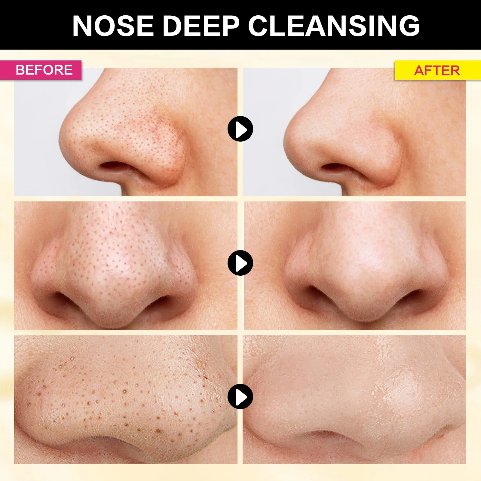 Tiefenreinigende Nasenporenstreifen, 3-teilig – Mitesser entfernen und Öl mit Hexennaspeln reduzieren, Poren verfeinern, für glatte, saubere Haut