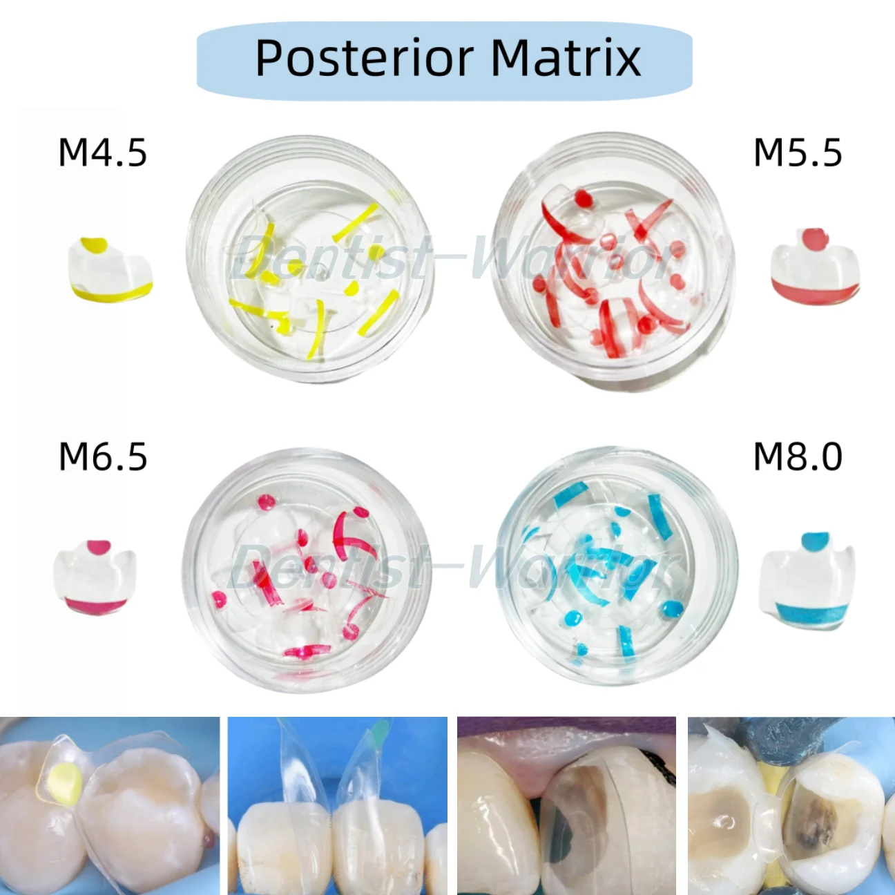 M4.5-M8.0 Dental Posterior Clear Matrix Restorative BT Bow Matrices Fit BioClear