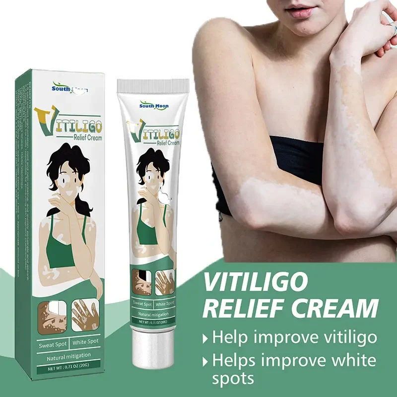 Crème de traitement du vitiligo biologique avec extrait de plantes, élimination des taches blanches et de la teigne