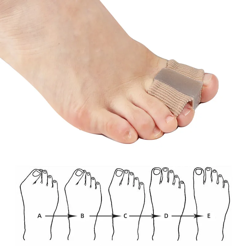 1Piece Hammer Toe Hallux Valgus Gel Silicone Straightener Foot Care Separators Thumb Adjuster Bunions Corrector Pain Relief