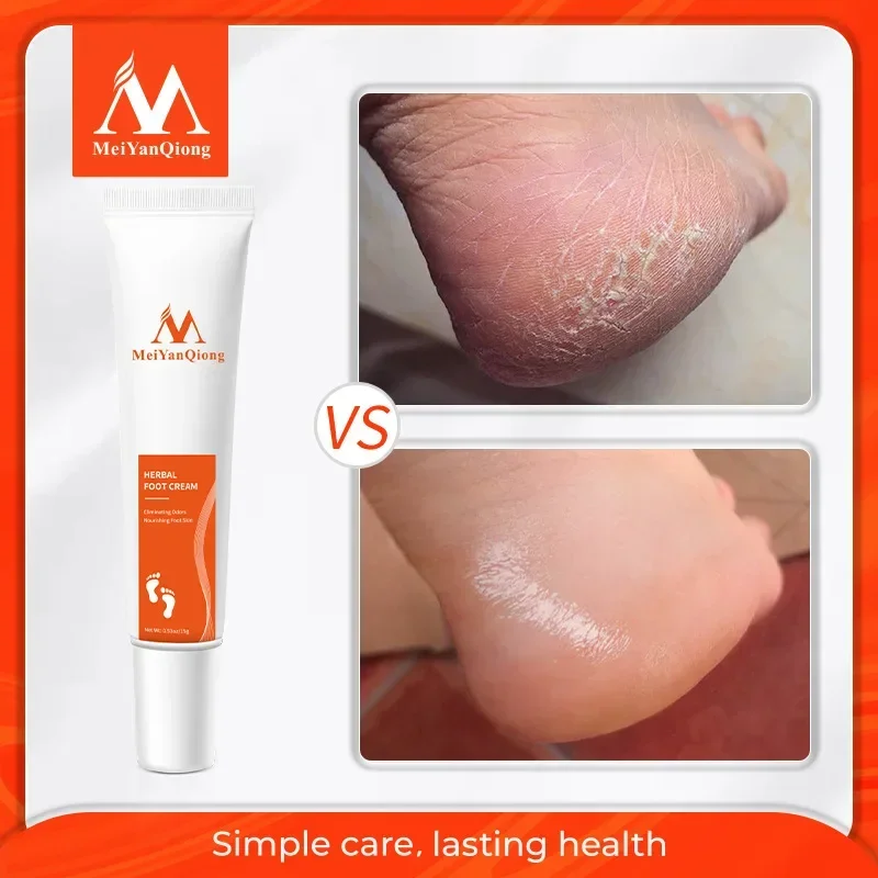 

Anti-wear Foot Cream Anti Crack Herbal Anti-Drying Heel Chapped Repair Dead Skin Foot Mask Moisturizing Hand Relive Pain Skin