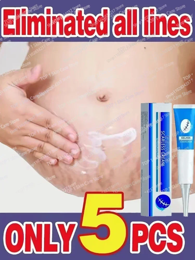 

Eliminate Red White Old Stretch Marks Cream For Pregnancy Postpartum Skin Care Gel 1006